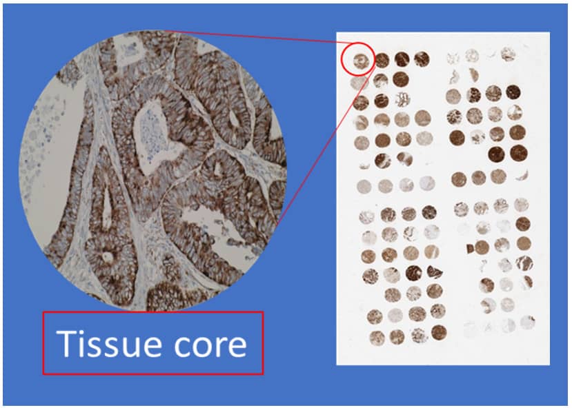 tissue core